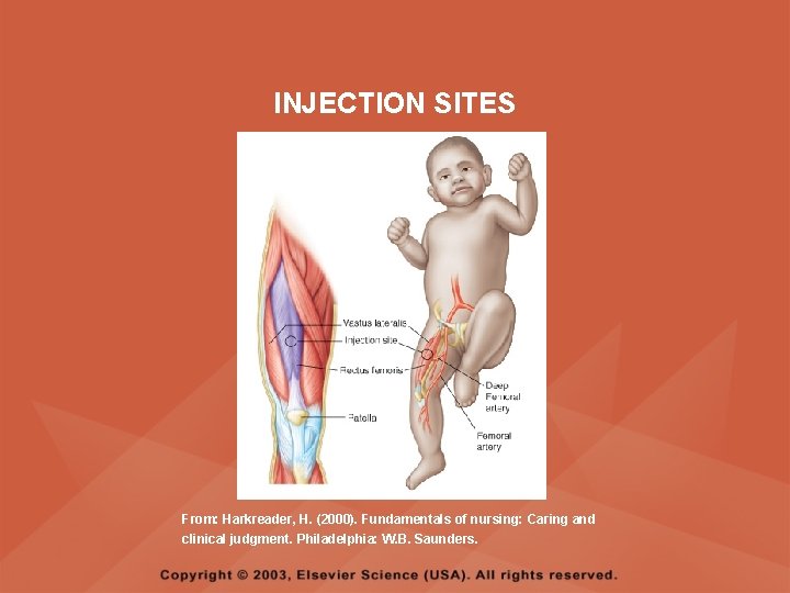 INJECTION SITES From: Harkreader, H. (2000). Fundamentals of nursing: Caring and clinical judgment. Philadelphia: