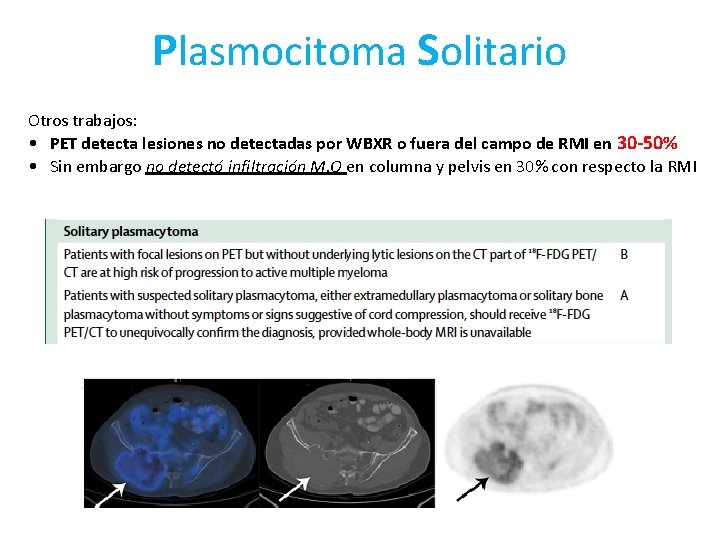 Plasmocitoma Solitario Otros trabajos: • PET detecta lesiones no detectadas por WBXR o fuera