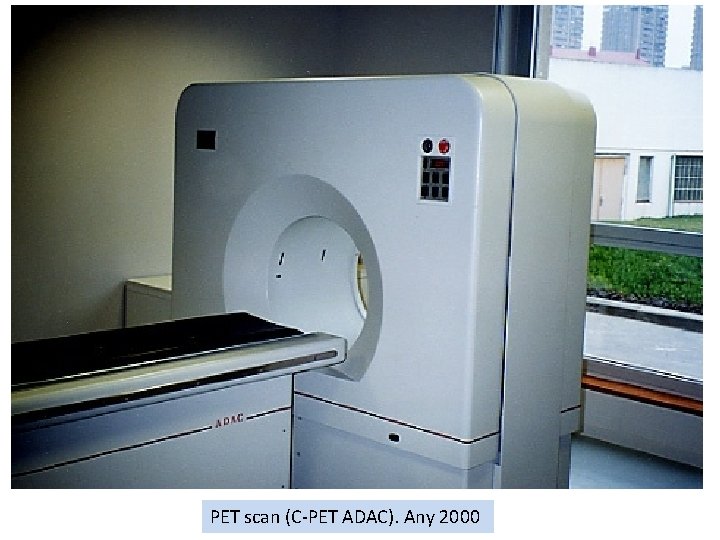 PET scan (C-PET ADAC). Any 2000 