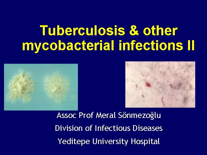 Tuberculosis & other mycobacterial infections II Assoc Prof Meral Sönmezoğlu Division of Infectious Diseases