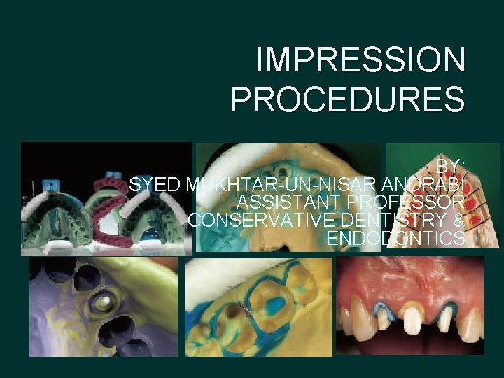 IMPRESSION PROCEDURES BY: SYED MUKHTAR-UN-NISAR ANDRABI ASSISTANT PROFESSOR CONSERVATIVE DENTISTRY & ENDODONTICS 
