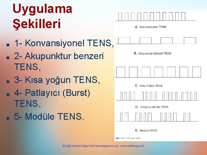 Uygulama Şekilleri ■ ■ ■ 1 - Konvansiyonel TENS, 2 - Akupunktur benzeri TENS, Uygulama Şekilleri ■ ■ ■ 1 - Konvansiyonel TENS, 2 - Akupunktur benzeri TENS,