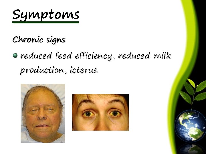 Symptoms Chronic signs reduced feed efficiency, reduced milk production, icterus. 