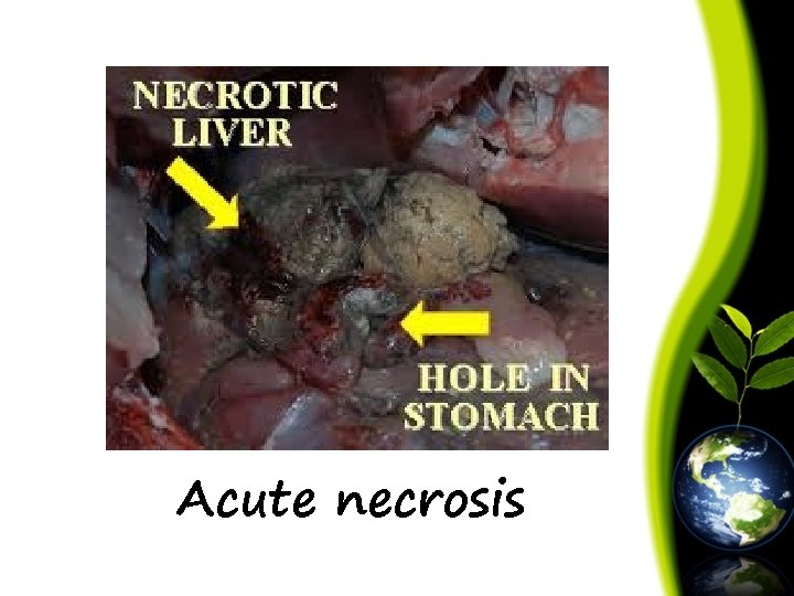 Acute necrosis 