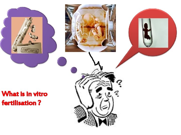 What is in vitro fertilisation ? 