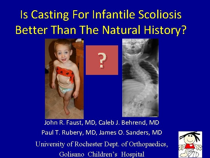 Is Casting For Infantile Scoliosis Better Than The Natural History? ? John R. Faust,