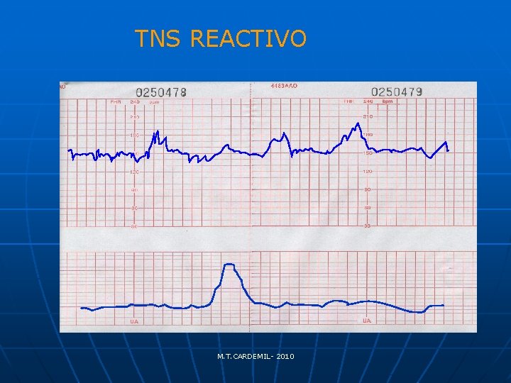 TNS REACTIVO M. T. CARDEMIL- 2010 