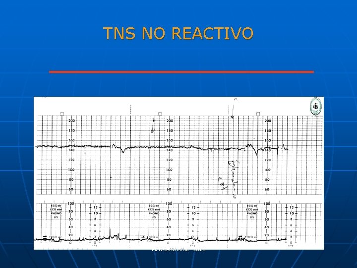 TNS NO REACTIVO M. T. CARDEMIL- 2010 