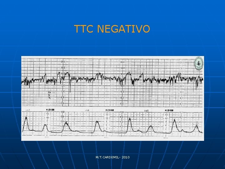 TTC NEGATIVO M. T. CARDEMIL- 2010 