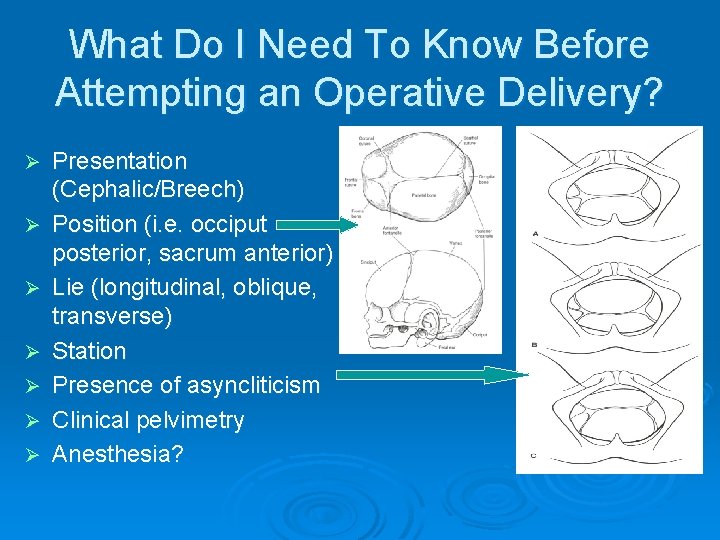 What Do I Need To Know Before Attempting an Operative Delivery? Ø Ø Ø