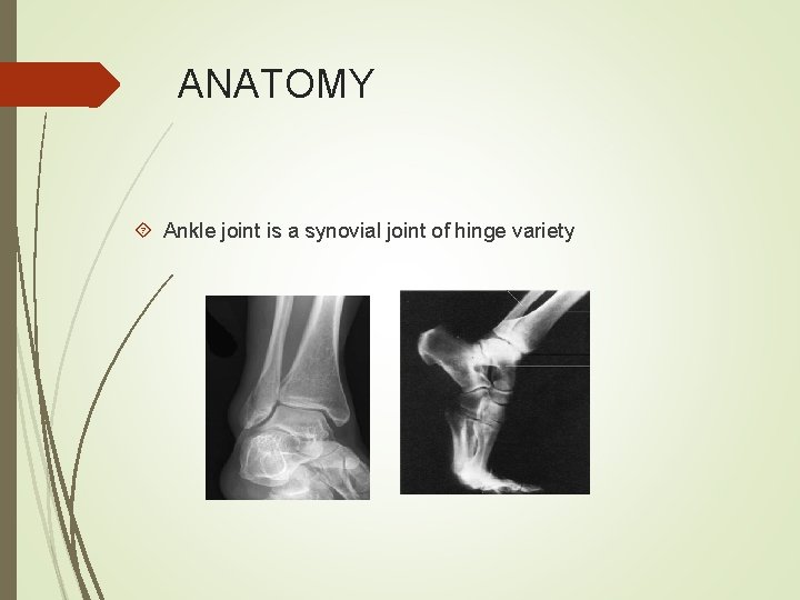 ANATOMY Ankle joint is a synovial joint of hinge variety 