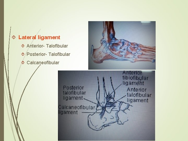 Lateral ligament Anterior- Talofibular Posterior- Talofibular Calcaneofibular 
