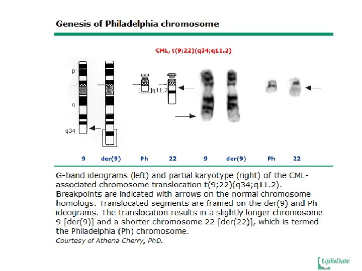 Myeloproliferative Neoplasms MPN MPNCMPD Multipotent hematopoietic ...
