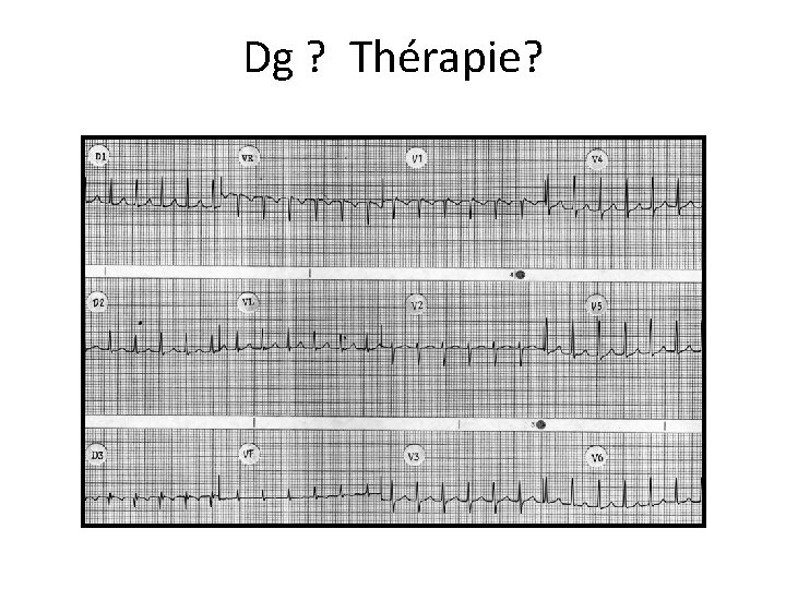 Dg ? Thérapie? 