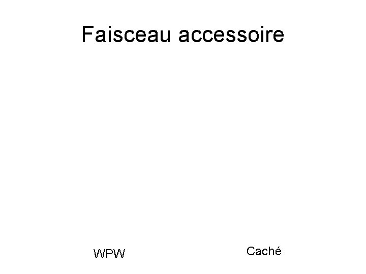 Faisceau accessoire WPW Caché 