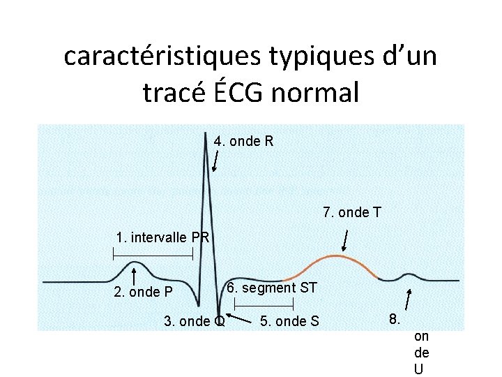 caractéristiques typiques d’un tracé ÉCG normal 4. onde R 7. onde T 1. intervalle