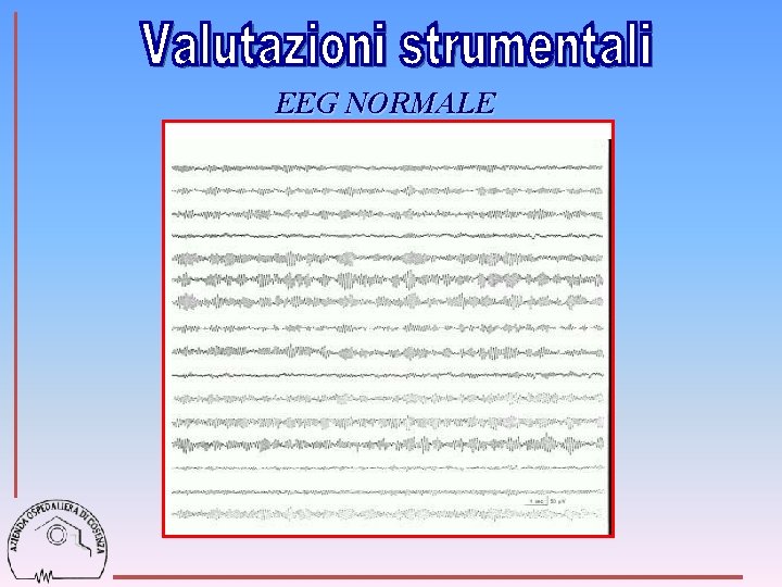 EEG NORMALE 