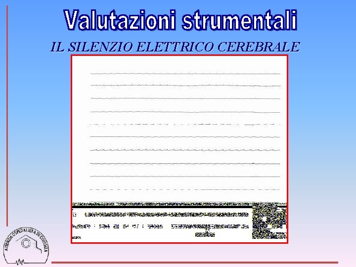 IL SILENZIO ELETTRICO CEREBRALE 