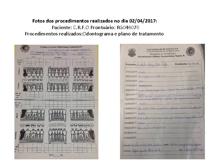 Fotos dos procedimentos realizados no dia 02/04/2017: Paciente: C. R. F. O Prontuário: RG