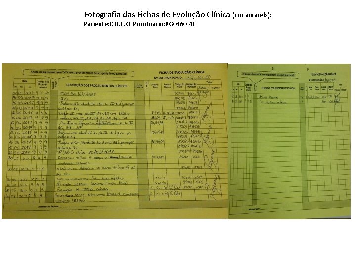 Fotografia das Fichas de Evolução Clínica (cor amarela): Paciente: C. R. F. O Prontuario: