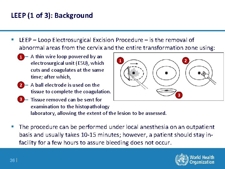 LEEP (1 of 3): Background § LEEP – Loop Electrosurgical Excision Procedure – is