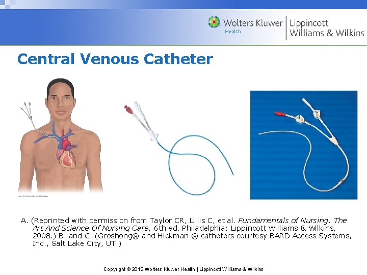 Central Venous Catheter A. (Reprinted with permission from Taylor CR, Lillis C, et al.
