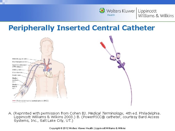 Peripherally Inserted Central Catheter A. (Reprinted with permission from Cohen BJ. Medical Terminology, 4