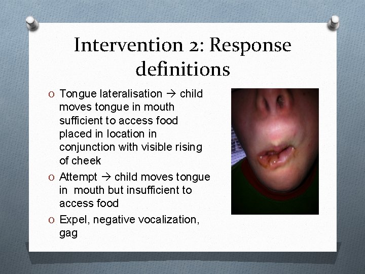 Intervention 2: Response definitions O Tongue lateralisation child moves tongue in mouth sufficient to