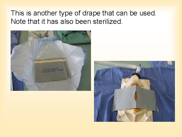 This is another type of drape that can be used. Note that it has This is another type of drape that can be used. Note that it has