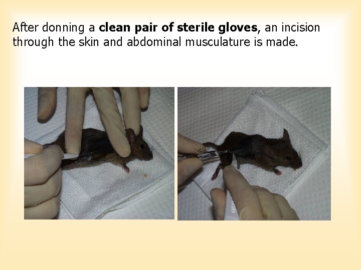 After donning a clean pair of sterile gloves, an incision through the skin and After donning a clean pair of sterile gloves, an incision through the skin and