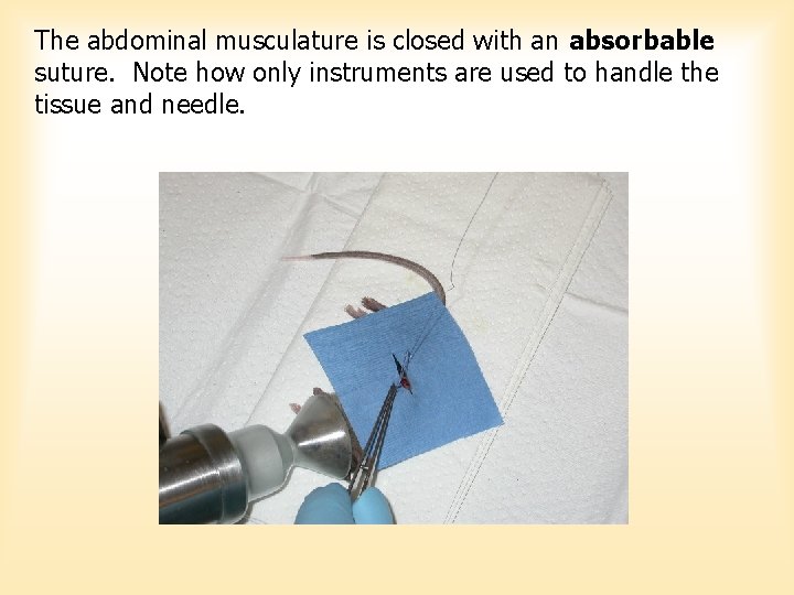 The abdominal musculature is closed with an absorbable suture. Note how only instruments are The abdominal musculature is closed with an absorbable suture. Note how only instruments are