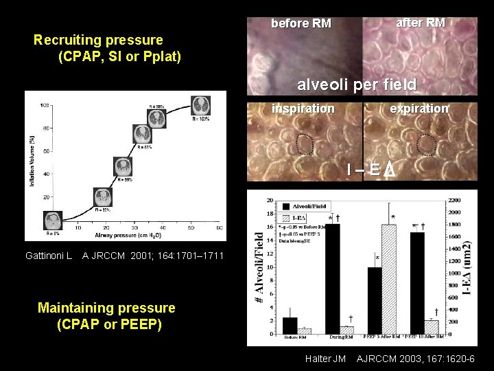 after RM before RM Recruiting pressure (CPAP, SI or Pplat) alveoli per field inspiration after RM before RM Recruiting pressure (CPAP, SI or Pplat) alveoli per field inspiration