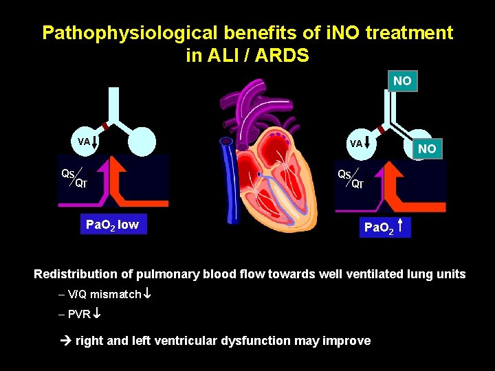 Pathophysiological benefits of i. NO treatment in ALI / ARDS NO VA QS QT Pathophysiological benefits of i. NO treatment in ALI / ARDS NO VA QS QT