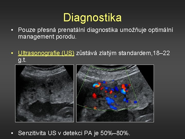 Diagnostika • Pouze přesná prenatální diagnostika umožňuje optimální management porodu. • Ultrasonografie (US) zůstává