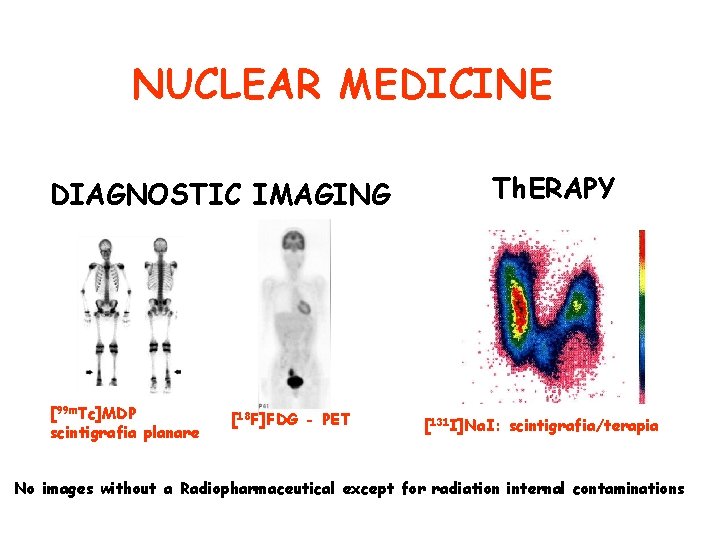 NUCLEAR MEDICINE DIAGNOSTIC IMAGING [99 m. Tc]MDP scintigrafia planare [18 F]FDG - PET Th.