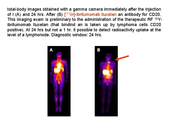 total-body images obtained with a gamma camera immediately after the injection of l (A)