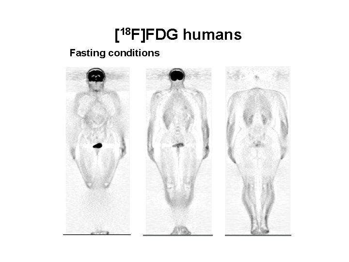 [18 F]FDG humans Fasting conditions 