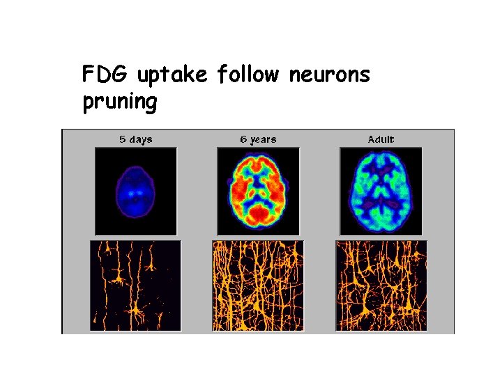 FDG uptake follow neurons pruning 