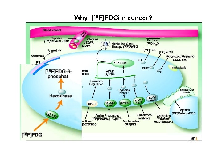 Why [18 F]FDGi n cancer? 