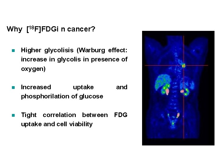 Why [18 F]FDGi n cancer? n Higher glycolisis (Warburg effect: increase in glycolis in
