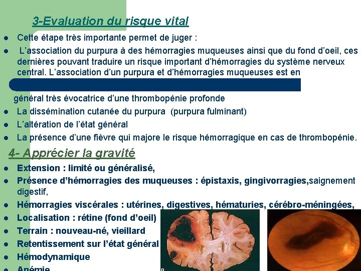 3 -Evaluation du risque vital l l Cette étape très importante permet de juger