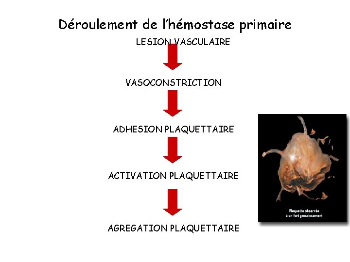 Déroulement de l’hémostase primaire LESION VASCULAIRE VASOCONSTRICTION ADHESION PLAQUETTAIRE ACTIVATION PLAQUETTAIRE AGREGATION PLAQUETTAIRE 
