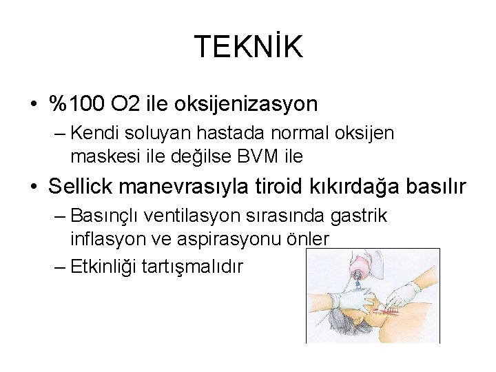 TEKNİK • %100 O 2 ile oksijenizasyon – Kendi soluyan hastada normal oksijen maskesi