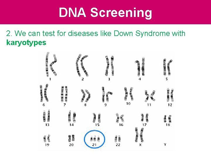 DNA Screening 2. We can test for diseases like Down Syndrome with karyotypes DNA Screening 2. We can test for diseases like Down Syndrome with karyotypes