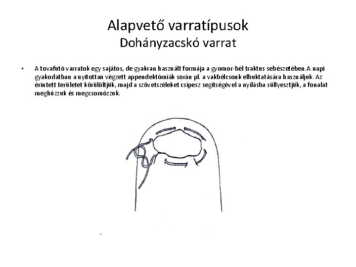 Alapvető varratípusok Dohányzacskó varrat • A tovafutó varratok egy sajátos, de gyakran használt formája