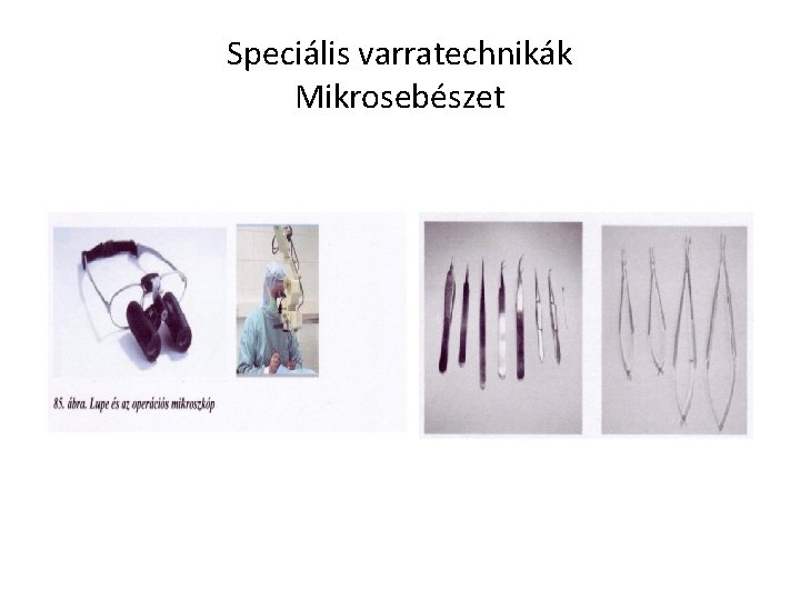 Speciális varratechnikák Mikrosebészet 