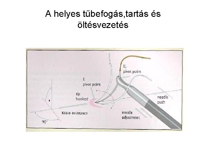 A helyes tűbefogás, tartás és öltésvezetés 