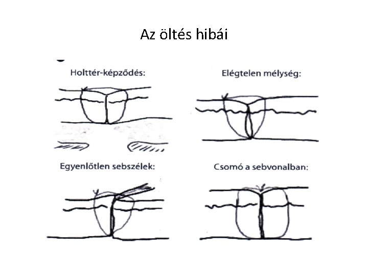 Az öltés hibái 