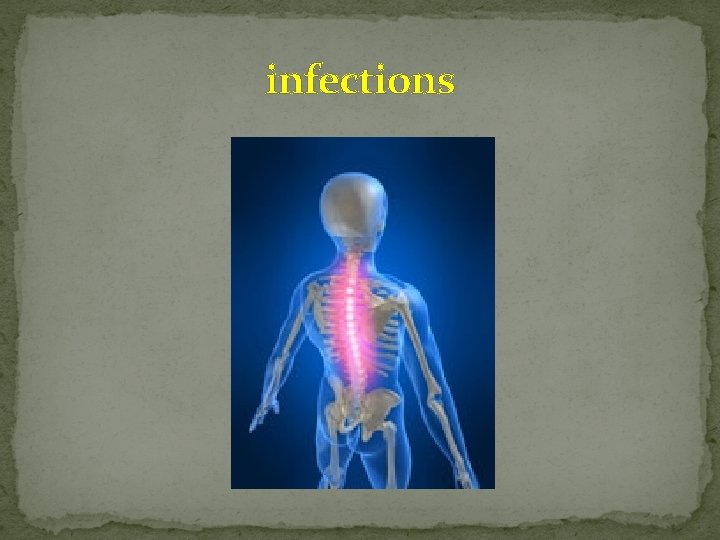 infections 