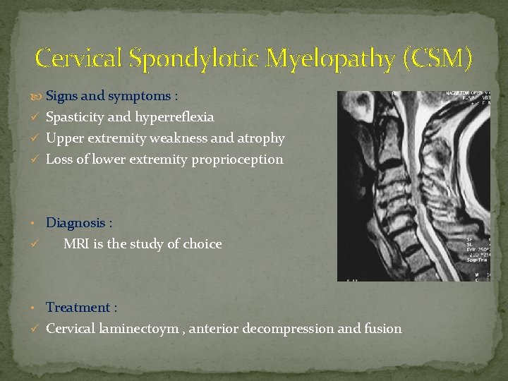 Cervical Spondylotic Myelopathy (CSM) Signs and symptoms : ü Spasticity and hyperreflexia ü Upper